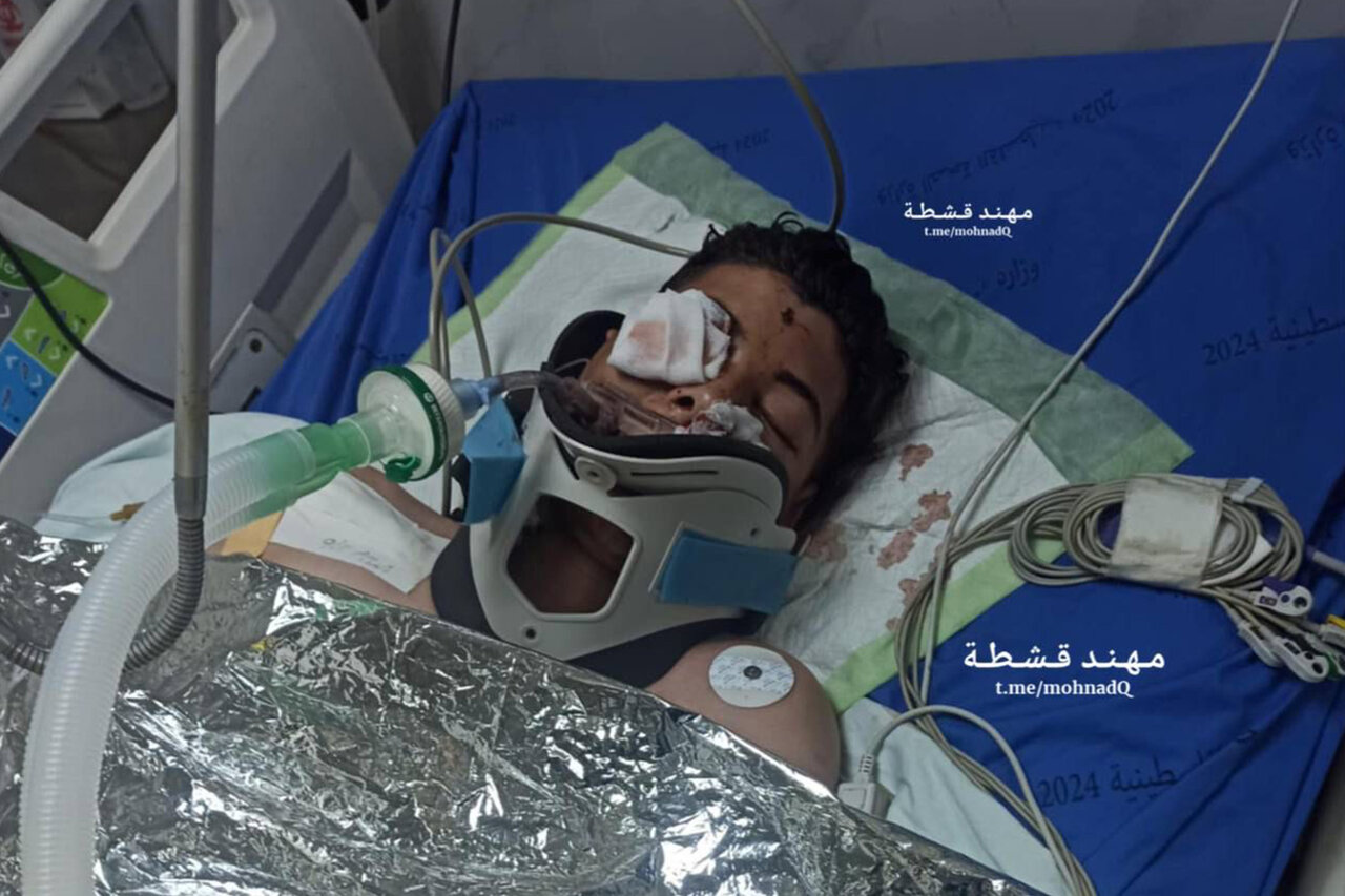 Two Palestinians succumb to serious injuries after being shot by Zionist gunfire