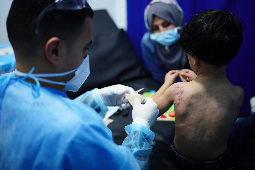 70% of burn victims in Gaza are children, little chance of recovery: MSF
