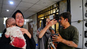 Iranian Health Minister: Israeli strikes injured 1,800 civilians