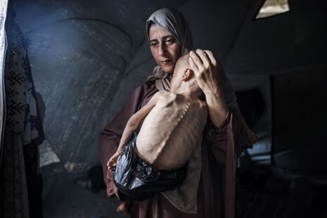 Gaza's hunger crisis at 'horrific level', warns American doctor