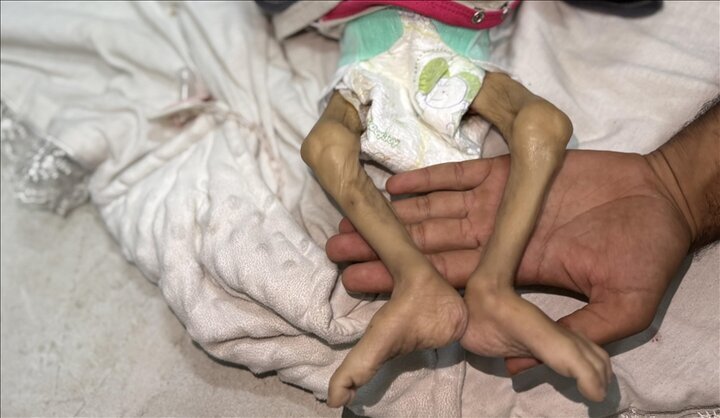 Infant dies of hunger at Gaza hospital amid blockade, death toll rises