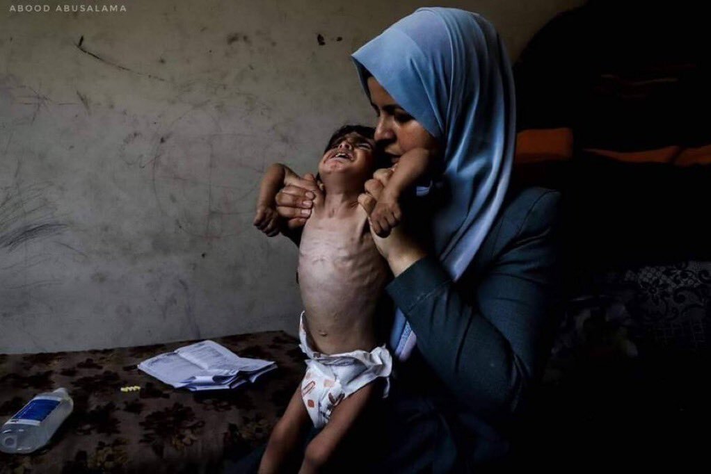 UN confirms famine outbreak in Gaza amid Israel’s blockade