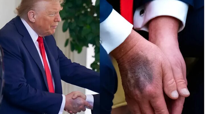 Is Donald Trump dead?