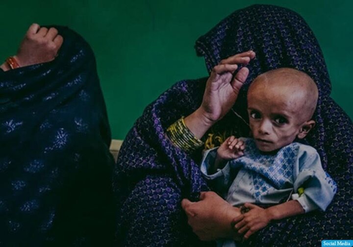 برنامه جهانی غذا بحران «سوء تغذیه» در افغانستان را رو به افزایش دانست