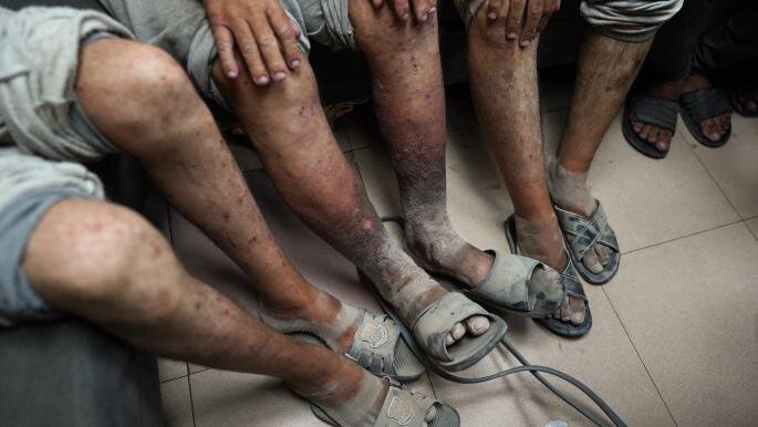 Palestinian Prisoners Face Life-Threatening Neglect in Ramon Prison