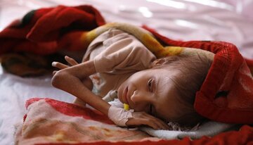 Int’l report: Two-thirds of population in 10 countries, including Yemen, face acute hunger
