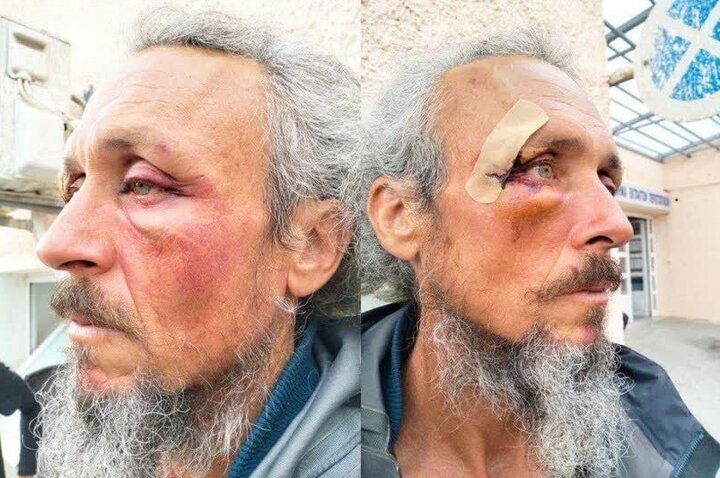 جزئیات هولناک از شکنجه ۴۰ ساعته فعالان کاروان صمود