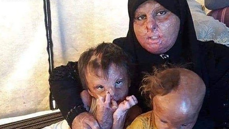  Burning Palestinian civilians by Israel, a model of America's massacre in Japan