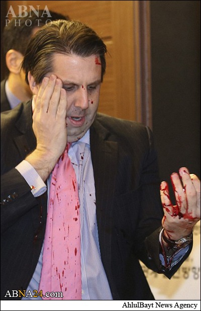US Ambassador to South Korea attacked in Seoul + Photos